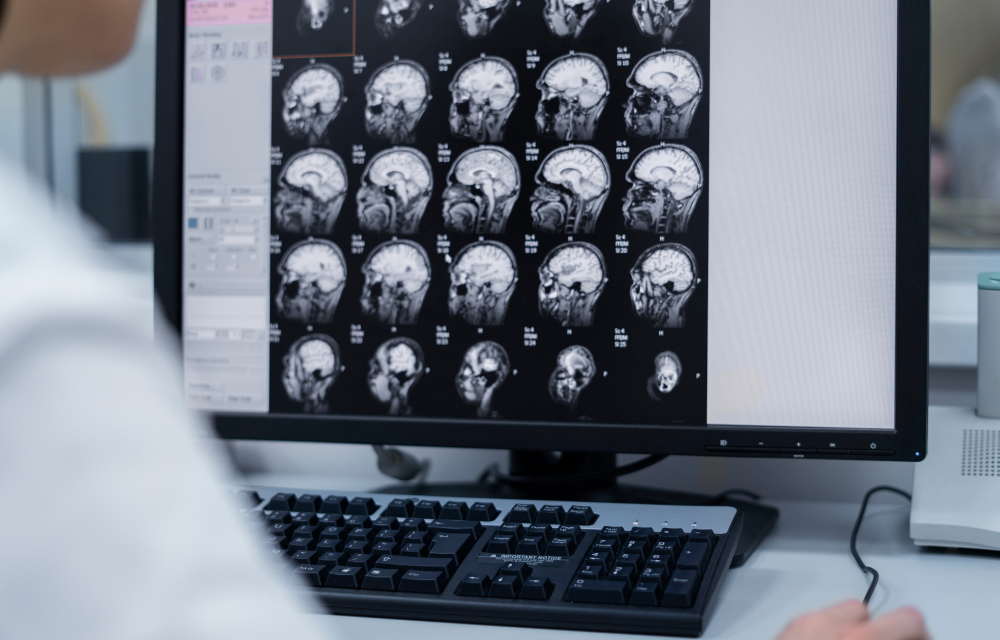 待機時間ゼロを目指す「画像ビューアシステム」